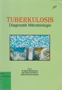 TUBERKULOSIS Diagnostik Mikrobiologis
